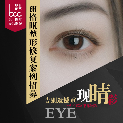 麗格眼整形修復案例招募