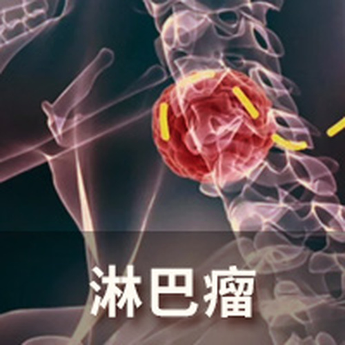 北京天健醫院特聘專家李佩文、楊中講解淋巴瘤