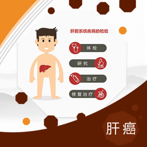 鐘偉專家講述肝癌治療方法