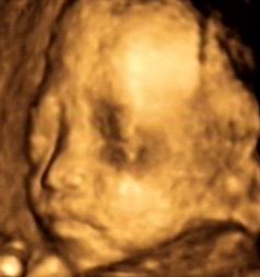 周兴平宝宝0岁第一次影集