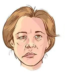 面神经瘤引起的面瘫如何治疗？