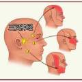 三叉神經(jīng)痛吃藥有效嗎？