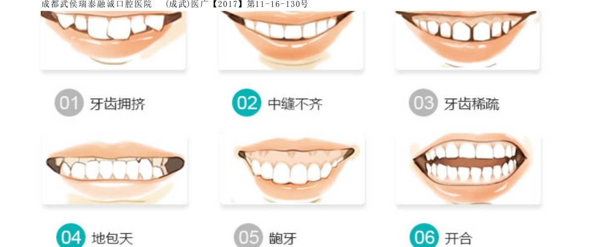 牙齒矯價格