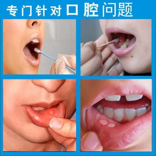 口腔潰瘍專科加盟店